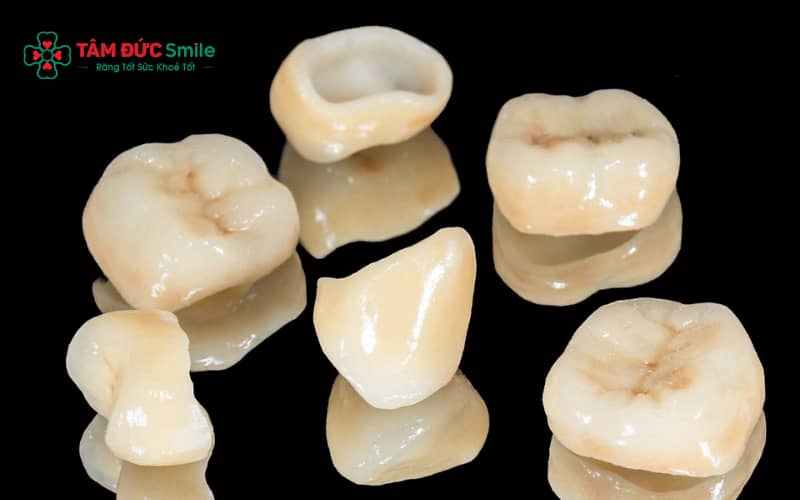 Nhận biết răng sứ cần thay: mão lỏng, nứt, răng đổi màu hoặc nướu viêm kéo dài