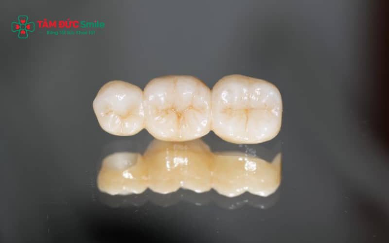Lựa chọn răng sứ phù hợp: toàn sứ cao cấp, zirconia hoặc Emax, đảm bảo thẩm mỹ và độ bền