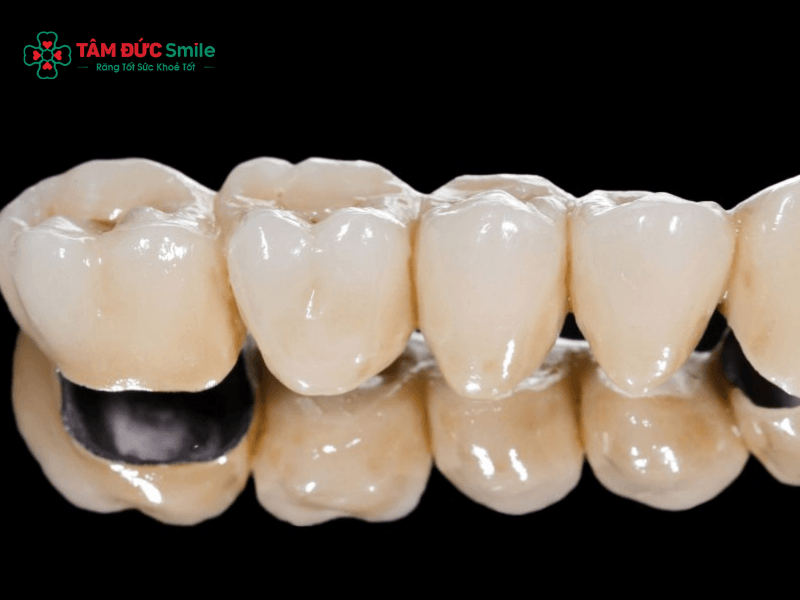 Chất liệu răng sứ: các loại răng sứ Zirconia, Cercon, Emax bền đẹp