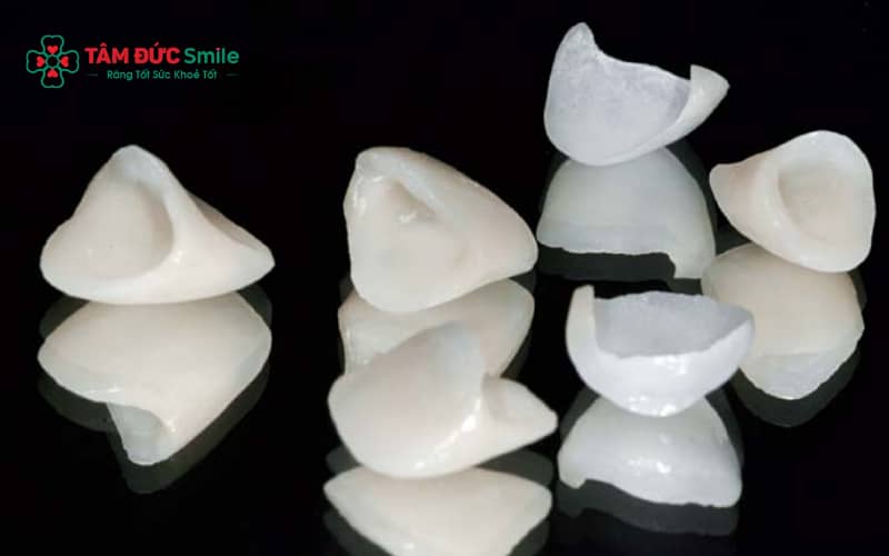 Khách hàng dễ lựa chọn răng sứ phù hợp: kim loại, Titan hoặc toàn sứ cao cấp, bền và thẩm mỹ