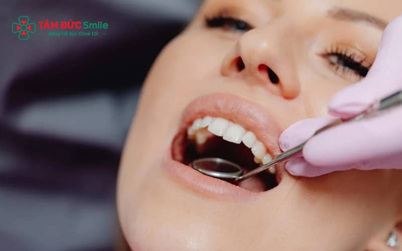Chăm sóc đúng cách như cắn gạc, ăn uống hợp lý và vệ sinh răng miệng giúp vết thương nhanh hồi phục sau nhổ răng khôn.