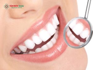Nên tẩy trắng răng hay bọc sứ? So sánh chi phí, độ bền, thẩm mỹ