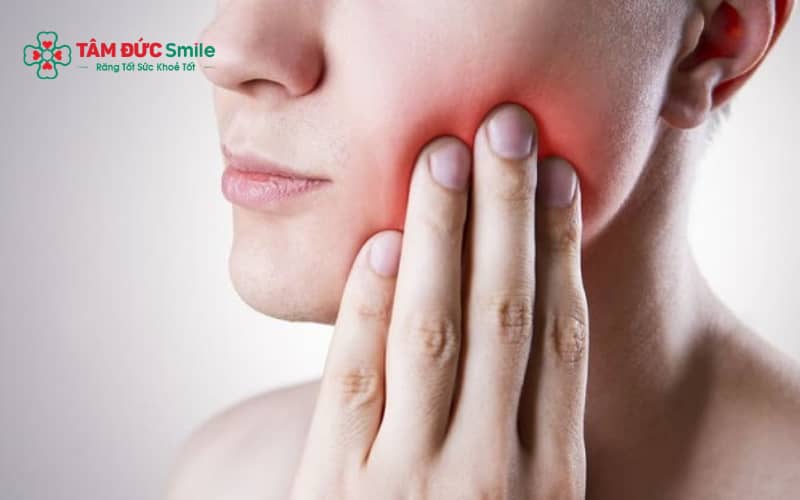Sưng hạch kèm sốt, đau kéo dài hoặc tăng kích thước là dấu hiệu cảnh báo cần thăm khám sớm