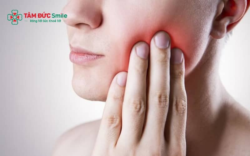 Chườm lạnh, dùng thuốc theo chỉ định và chăm sóc đúng cách giúp giảm sưng nhanh sau khi nhổ răng khôn.