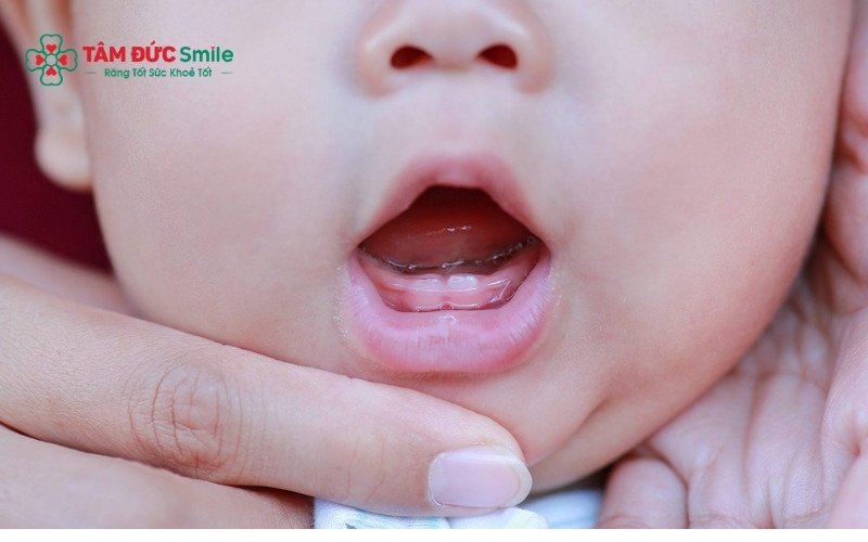 Trẻ mọc răng lần đầu thường có dấu hiệu chảy dãi nhiều, thích cắn đồ vật và hay quấy khóc