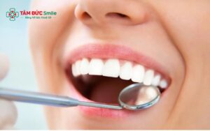 Nhận diện hàm răng chuẩn đẹp? Tiêu chí đánh giá?