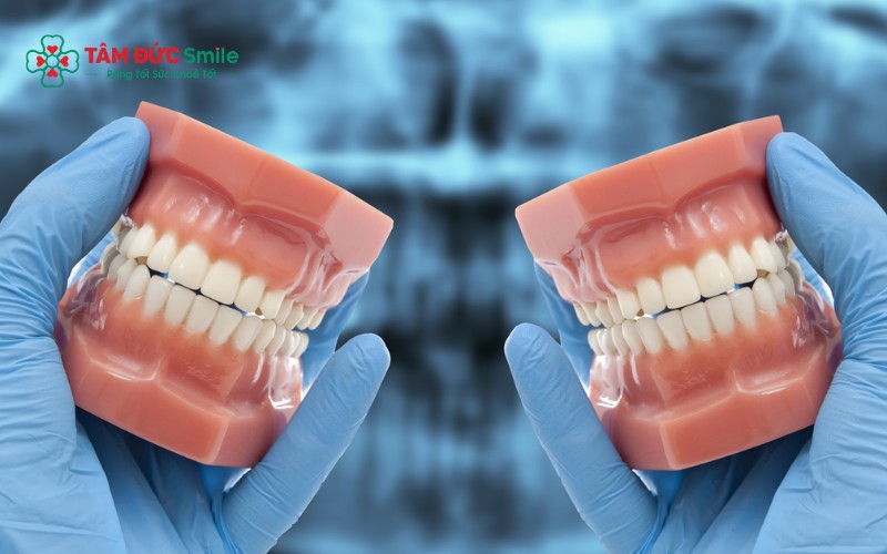 Sở hữu hàm răng đẹp giúp tăng sự tự tin, cải thiện giao tiếp và tạo ấn tượng tốt với người đối diện