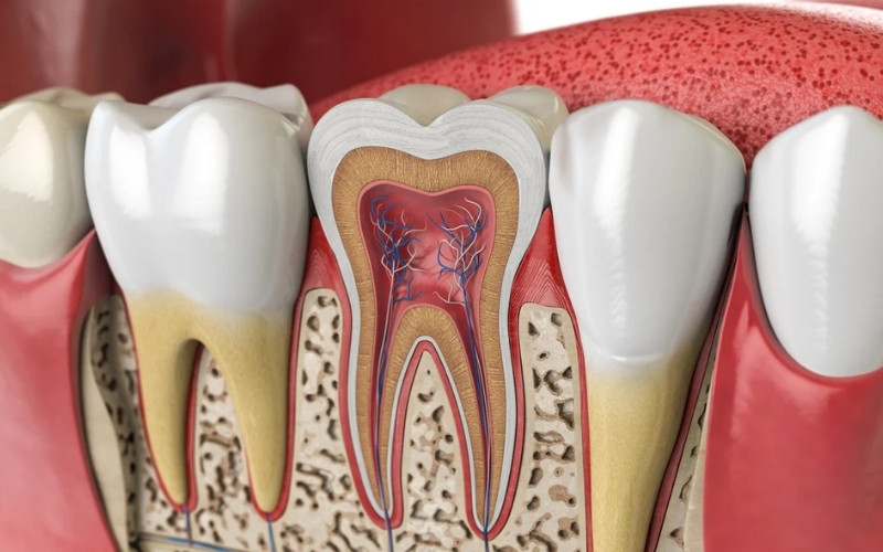 Răng sau khi lấy tủy có thể bị lung lay do viêm nha chu, lực nhai quá lớn hoặc cấu trúc răng suy yếu