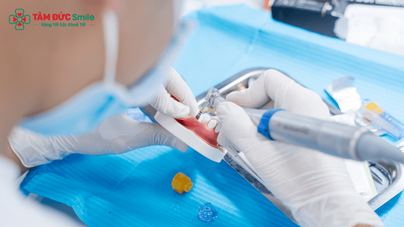 dentis-vietnam-to-chuc-workshop-thuc-chien-implant-can-ban-va-nang-xoang-kin-cung-bs-ngo-minh-tri-2