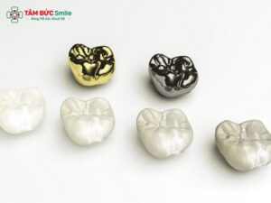 Nên bọc răng sứ loại nào tốt? So sánh răng toàn sứ, Cercon