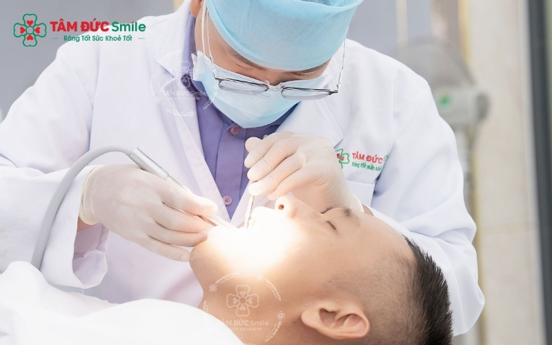 Tùy vào tình trạng cụ thể, bác sĩ sẽ thực hiện nội nha chuyên sâu hoặc bọc răng sứ để bảo tồn chức năng và thẩm mỹ cho răng vôi hóa.