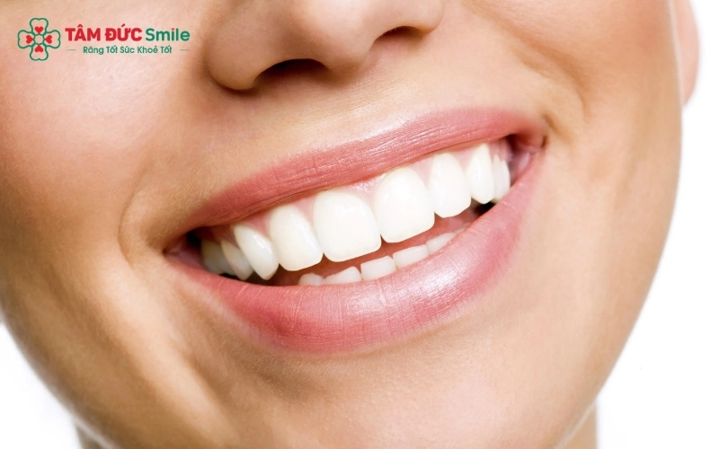 Những người bị mòn cổ chân răng hoặc bệnh lý nướu cần được điều trị triệt để trước khi thực hiện tẩy trắng