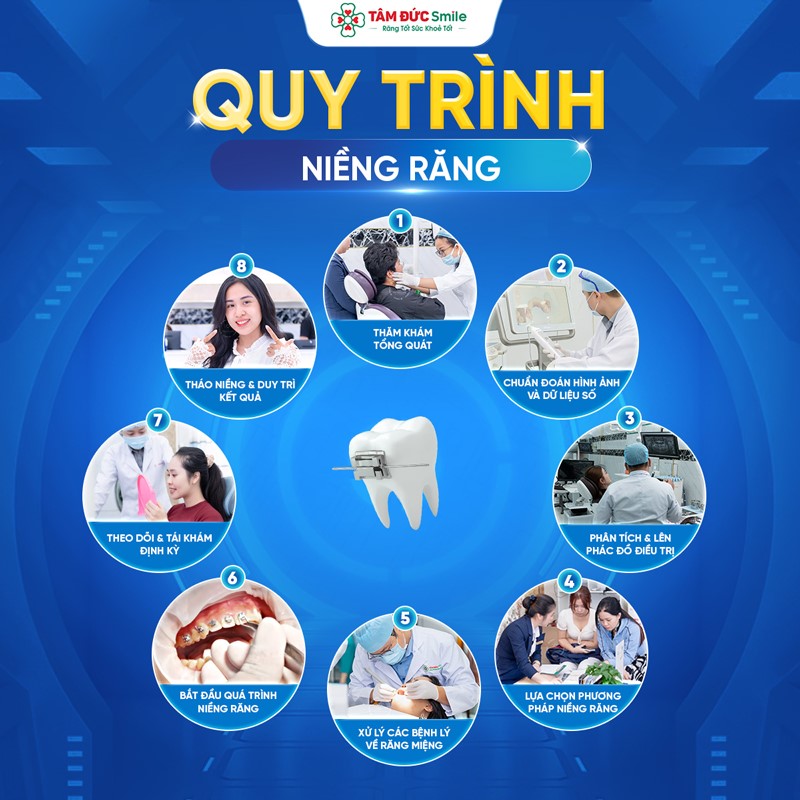 Quy trình niềng răng 8 bước tại Nha khoa Tâm Đức Smile, từ thăm khám đến tháo niềng và duy trì kết quả.